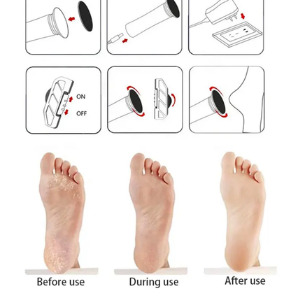 Electric Foot Callus Remover & Pedicure File Set